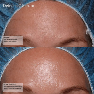 Face Reality Defense C Serum before and after 12 weeks - forehead showing reduced pore size and improved skin radiance and texture - available at The Art of Skin Care