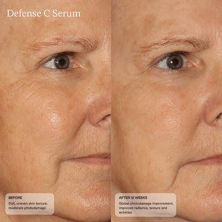 Face Reality Defense C Serum before and after 12 weeks - face showing improved radiance reduced wrinkles and photodamage correction - available at The Art of Skin Care