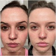 Epicutis Arctigenin Brightening Treatment - Art of Skin Care