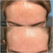 Epicutis Arctigenin Brightening Treatment - Art of Skin Care