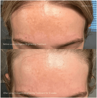 Epicutis Arctigenin Brightening Treatment - Art of Skin Care