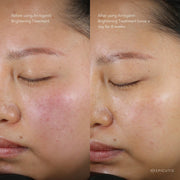Epicutis Arctigenin Brightening Treatment - Art of Skin Care