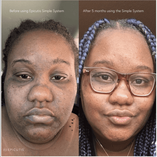 Epicutis Discovery Set - Art of Skin Care