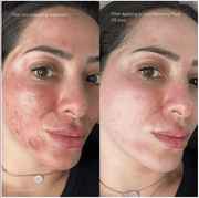 Epicutis Lipid Recovery Mask for Face - Art of Skin Care