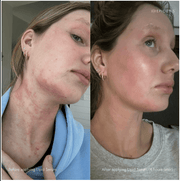 Epicutis Lipid Serum - Art of Skin Care