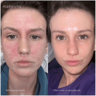 Epicutis Luxury Essentials Set - Art of Skin Care