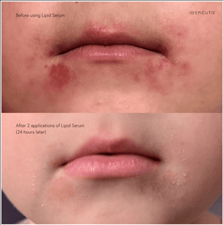 Epicutis Luxury Essentials Set - Art of Skin Care