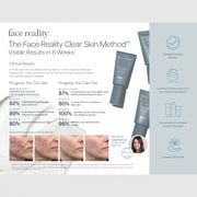 Face Reality Clear Skin Method clinical results – 89% showed reduced acne severity by week 8, 16-week before and after progression photos