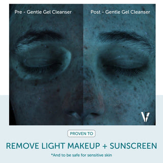 UV before and after showing Gentle Gel Cleanser removes light makeup and sunscreen residue
