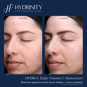 Hydrinity Hydri - C Daily Vitamin C Moisturizer - Art of Skin Care