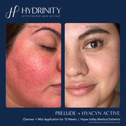 Hydrinity Prelude Facial Treatment Cleanser - Art of Skin Care