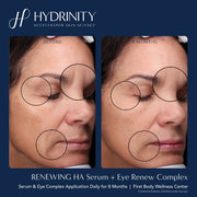 Hydrinity Renewing HA Serum - Art of Skin Care
