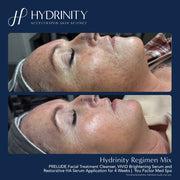 Hydrinity Restorative HA Serum - Art of Skin Care