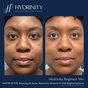 Hydrinity Restorative Kit - Art of Skin Care