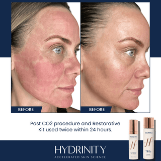 Hydrinity Restorative Kit - Art of Skin Care