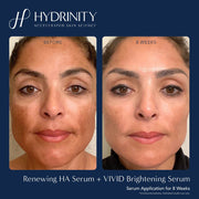 Hydrinity Vivid Brightening Serum - Art of Skin Care