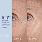 Clinical before and after close-up photos showing visibly reduced periorbital wrinkles around the eye after 30 days, with stat that 100% of subjects experienced improvement