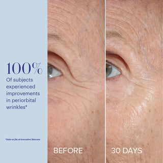 Clinical before and after close-up photos showing visibly reduced periorbital wrinkles around the eye after 30 days, with stat that 100% of subjects experienced improvement
