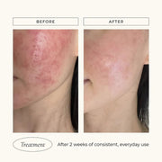 Le Mieux Iso - Cell Recovery Solution - Art of Skin Care