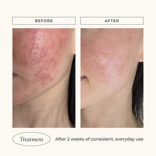 Le Mieux Iso - Cell Recovery Solution - Art of Skin Care