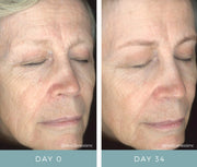 NeoGenesis Recovery Serum - Art of Skin Care