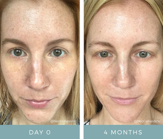 NeoGenesis Recovery Serum - Art of Skin Care