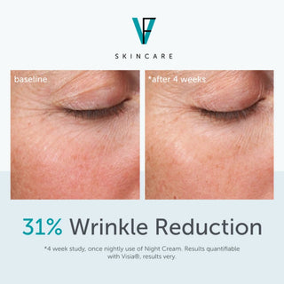 Before and after showing 31% wrinkle reduction after 4 weeks using Night Retinol Cream