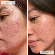 Omnilux Clear LED Mask - Art of Skin Care