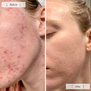 Omnilux Clear LED Mask - Art of Skin Care