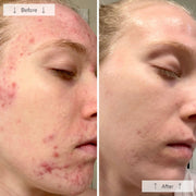 Omnilux Clear LED Mask - Art of Skin Care