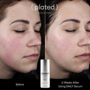 Plated Skin Science DAILY Serum - Art of Skin Care