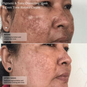 Senté Cysteamine HSA Pigment & Tone Correcting Mask - Art of Skin Care