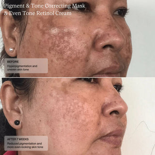 Senté Cysteamine HSA Pigment & Tone Correcting Mask - Art of Skin Care