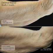 Senté Dermal Repair Body Cream - Art of Skin Care