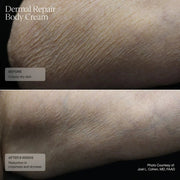 Senté Dermal Repair Body Cream - Art of Skin Care