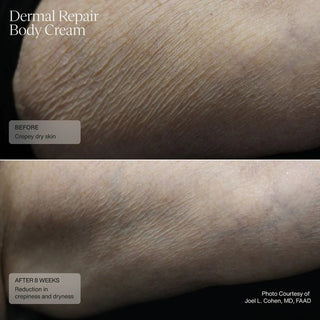 Senté Dermal Repair Body Cream - Art of Skin Care