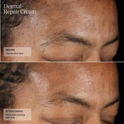 Senté Dermal Repair Cream - Art of Skin Care