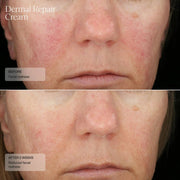 Senté Dermal Repair Cream - Art of Skin Care