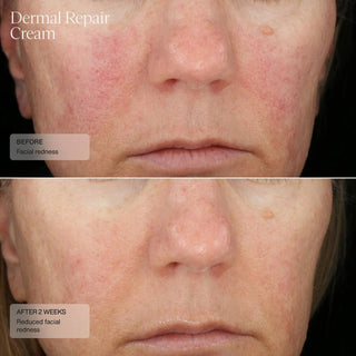 Senté Dermal Repair Cream - Art of Skin Care