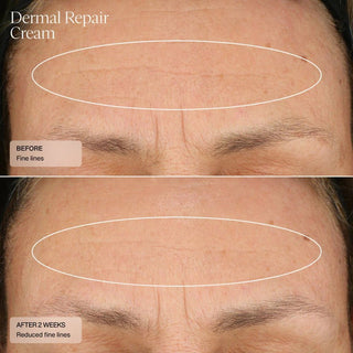Senté Dermal Repair Cream - Art of Skin Care