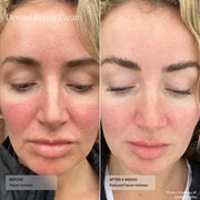 Senté Dermal Repair Cream - Art of Skin Care