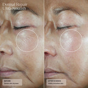 Senté Dermal Repair Ultra - Nourish - Art of Skin Care