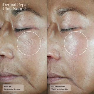 Senté Dermal Repair Ultra - Nourish - Art of Skin Care