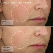 Senté Dermal Repair Ultra - Nourish - Art of Skin Care