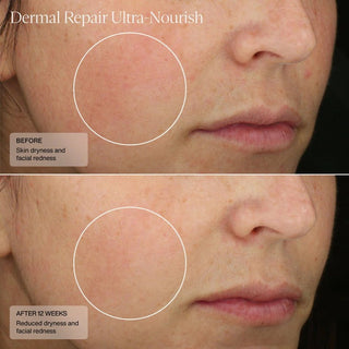 Senté Dermal Repair Ultra - Nourish - Art of Skin Care