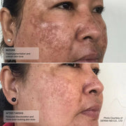 Senté Even Tone Retinol Cream - Art of Skin Care