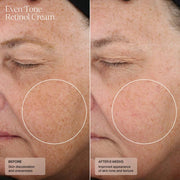 Senté Even Tone Retinol Cream - Art of Skin Care