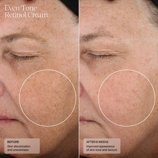 Senté Even Tone Retinol Cream - Art of Skin Care