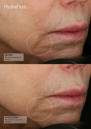 Senté HydraFirm Serum - Art of Skin Care