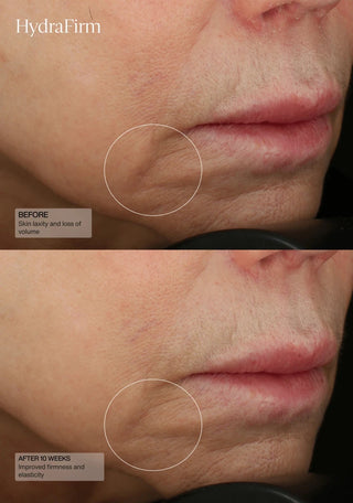 Senté HydraFirm Serum - Art of Skin Care